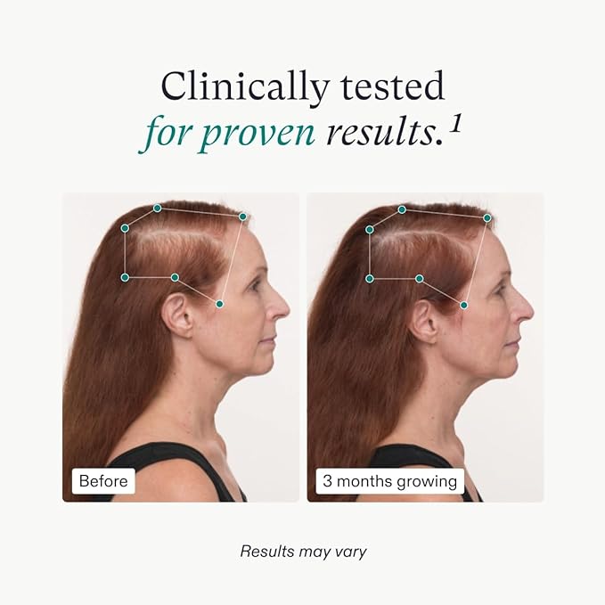 Nutrafol Women s Balance Hair Growth Supplements, Ages 45 and Up, Clinically Proven for Visibly Thicker Hair and Scalp Coverage, Dermatologist Recommended - 1 Month Supply